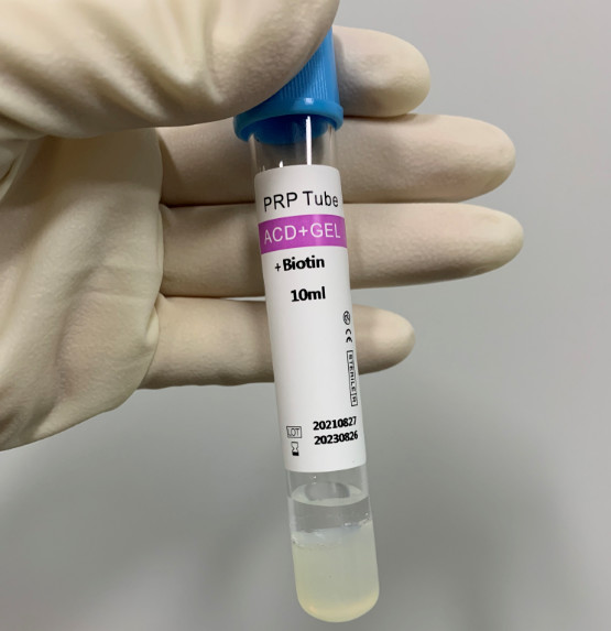 Buy cheap ACD PRP Products 1ml Centrifuge Tube Separation Of Blood Collection Vessels from wholesalers
