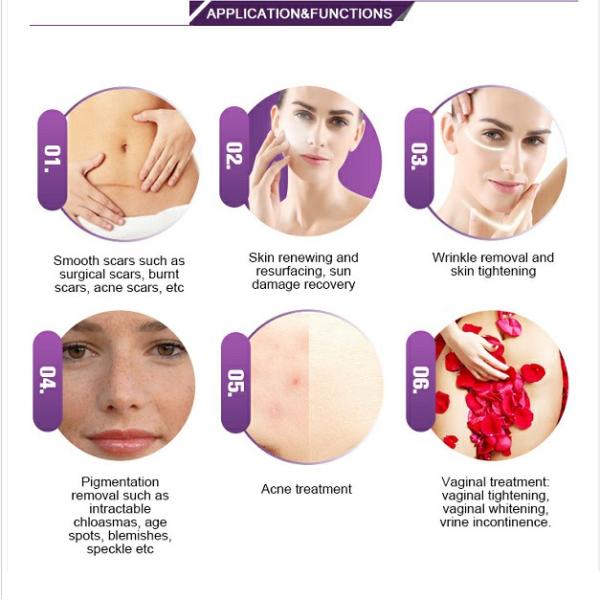 Commercial Fractional CO2 Laser Machine for Skin Resurfacing / Stretch Mark Removal