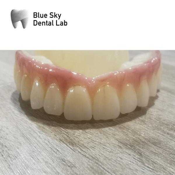 Nature Design Dental Implant Case Implant Operation Cases For Multiple Choices