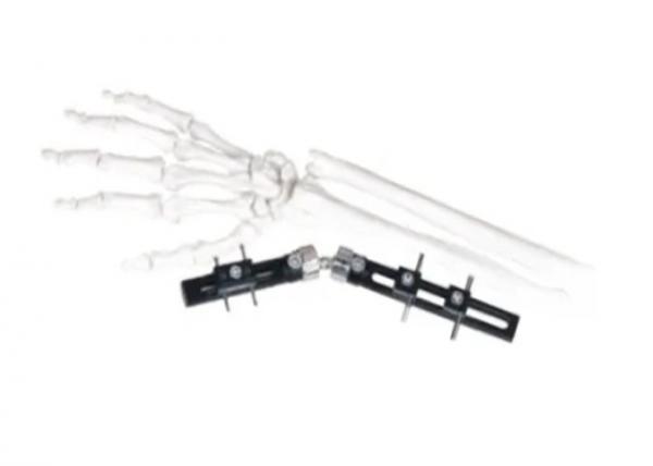 Quality Straight Pin Type Wrist Medical External Fixator minimal interference with soft-tissue for sale