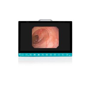 China TUYOU 13.3-Inch FHD Flexible Endoscope Camera System Multi-Color OEM Custom All-in-One Portable Uro-Gyn TikTok Hit wholesale