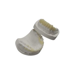 Buy cheap Custom TEMP Porcelain Tooth Crown Inlay Onlay Strong Hardness Veneer from wholesalers