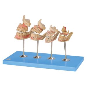 China Development Human Teeth Model for Hospitals , Schools , Colleges Training wholesale