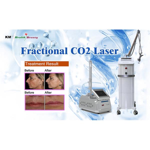 Commercial Fractional CO2 Laser Machine for Skin Resurfacing / Stretch Mark Removal