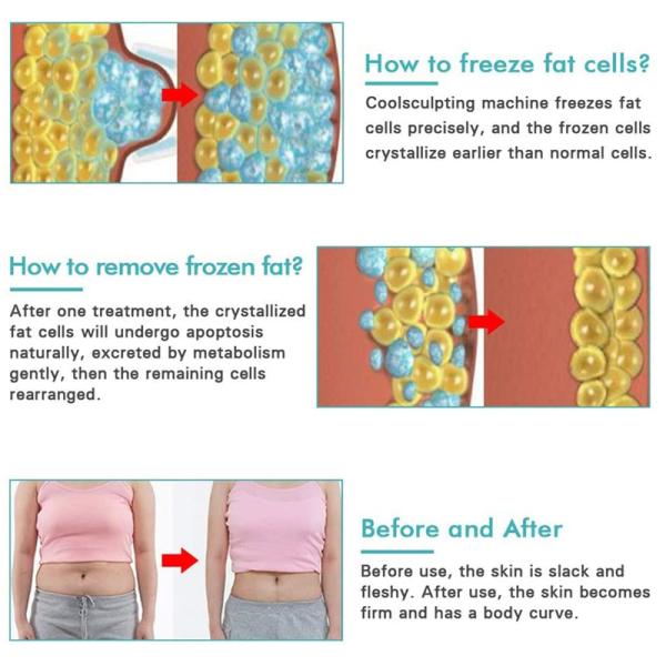 Portable Home Use Body Slim Machine Weight Loss Cryolipolysis Fat Freeze Belt