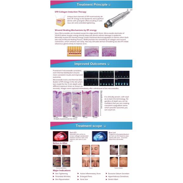 Face lift wrinkle removal superfacial RF and Microneedle RF 2 in 1 machine
