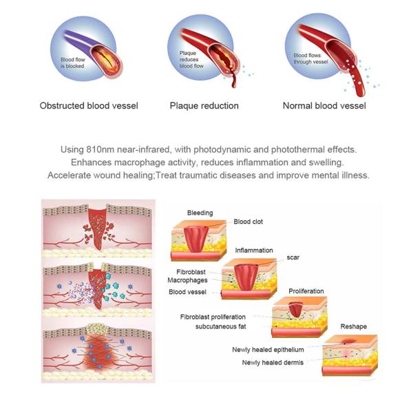Collagen Production Beauty LED Light Therapy Bed Full Body Phototherapy