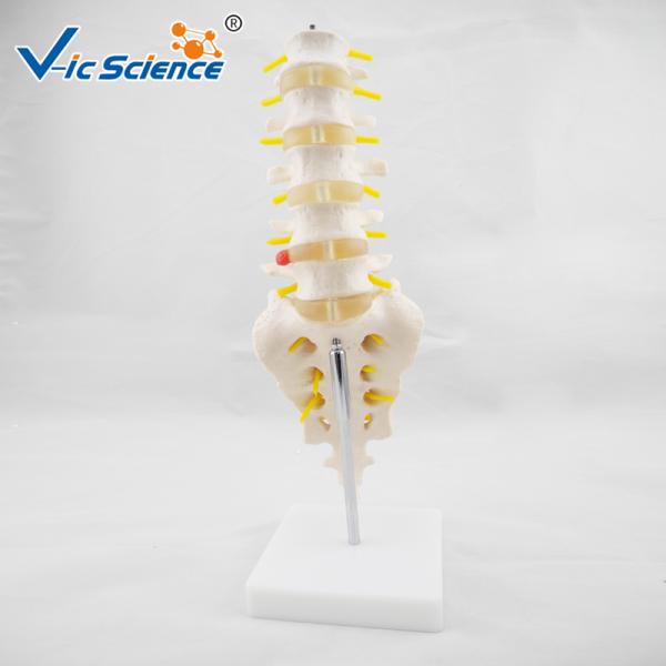 Life Size PVC Lumbar Vertebrae Model With Sacrum / Coccyx And Herniated Disc