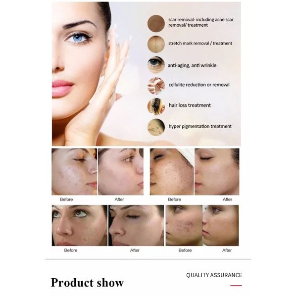 Professional Microneedling Pen - Wireless Derma Auto Pen - Best Skin Care Tool Kit for Face and Body