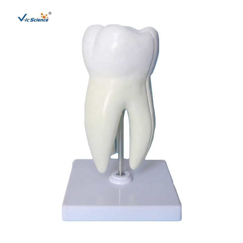 China Teeth Anatomical Model Molar Tooth Attach With Caries Maxillary 3 Roots Magnify wholesale