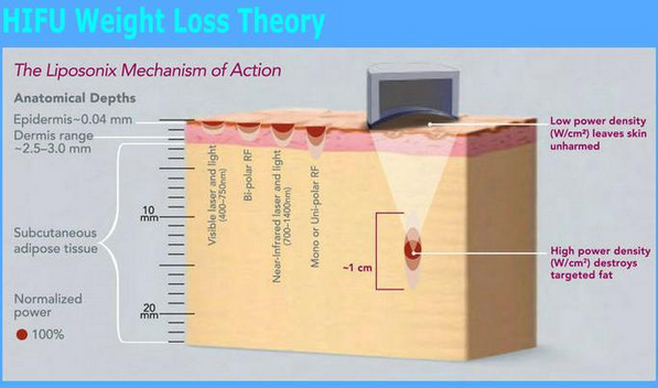 the cost effective fat reduce hifu slimming body shaping machine