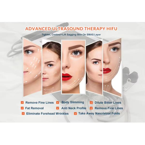 2 In 1 Liposonic Body Shaping Face Skin Lift Wrinkle Remover 4d Hifu Machine