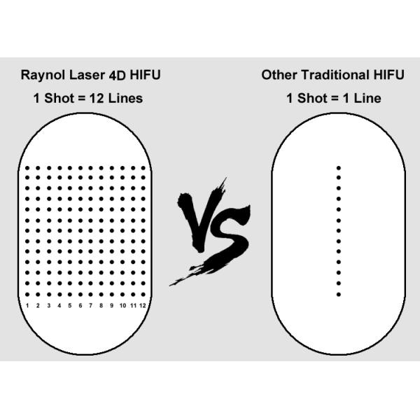 Vertical korea 4D Ultra Hifu Face Lifting Machine 4D HIFU 4 iN 1 portable hifu machine