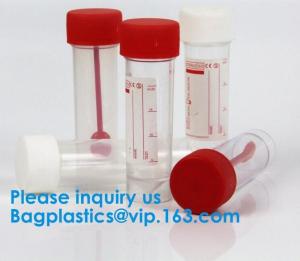 China Disposable Urine Specimen Cup/Urine Sample Containers/Urine Collection Cup,Sterile Disposable Hospital Sample 60ml 100 wholesale