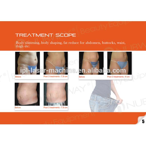 the cost effective fat reduce hifu slimming body shaping machine