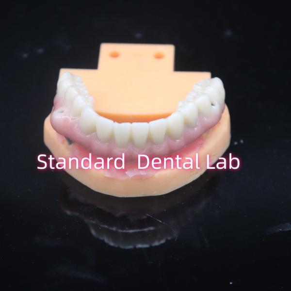 Biocompatible Tooth Colored Zirconia Dental Implant Bridge