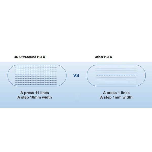 female intimate areal Tighten HIFU 2 In 1 Face Machine for Wrinkles Anti Winkle