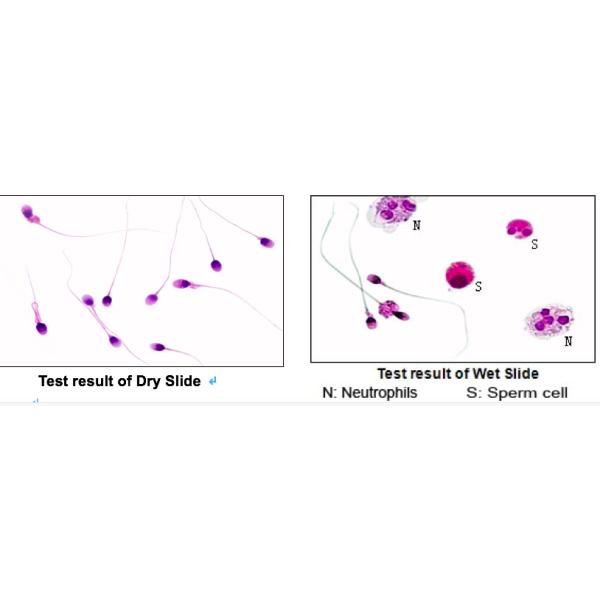 Blood Cell Morphology Test Pre Stained Slides