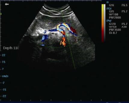 Video Report Portable Color Doppler Machine Ultrasound Scanner System With 2 Probe Connector