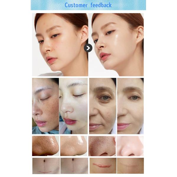 Hydra Dermabrasion Machine 200W Diamond Peeling Microdermabrasion Machine 8 In 1