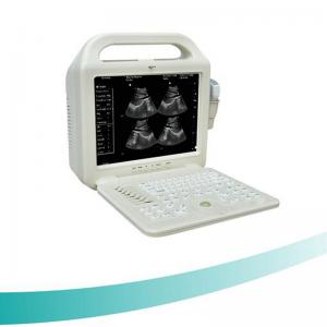 China 12 inch LCD monitor Medical Portable Ultrasound Scanner,Laptop B/W Ultrasound Scanner wholesale