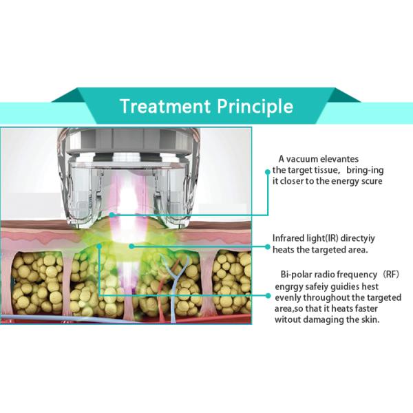 China new innovative product beauty salon use cellulite removal body shape vacuum roller slimming machine