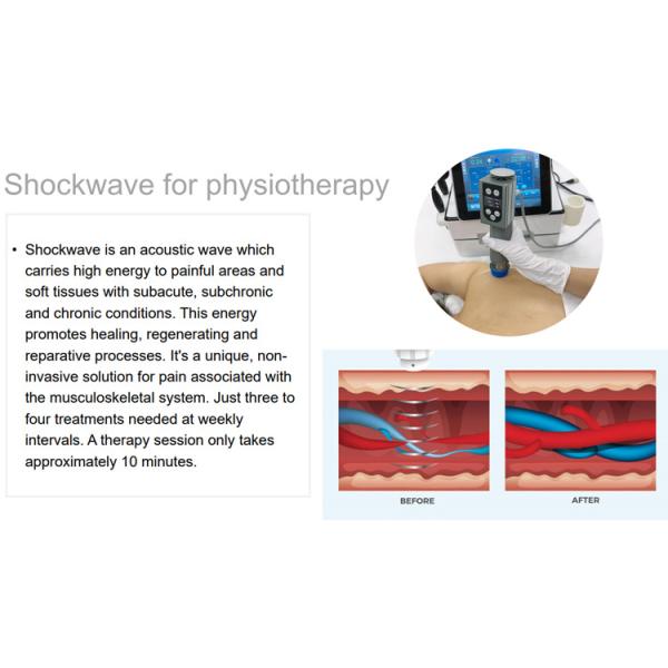 Physical therapy/shock wave therapy equipment extracorporeal/shockwave therapy tecar therapy pain relief