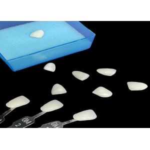 Porcelain Emax Veneer Translucency Bonding For Precise Esthetic Restorations