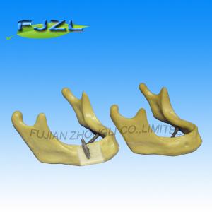 China dental implant manufacturers supply dental drill model wholesale