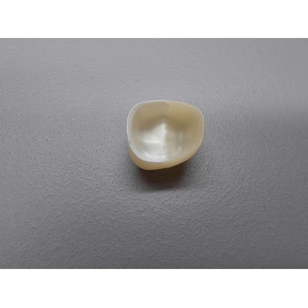 No Separate Glazing Dental Paste 12-38°C Storage Stability Manual Power Source Shelf Life 1years Steam/Ultrasonic Compatible