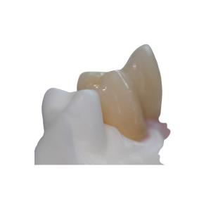 China Removable Pure Titanium Dental Implant Bar Custom Abutment wholesale