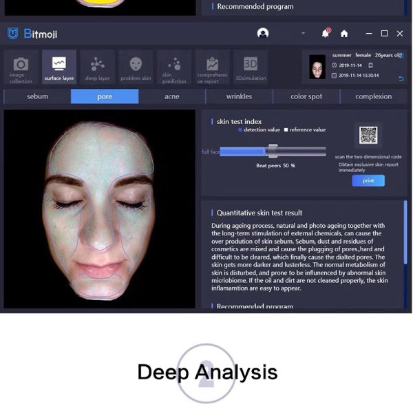 3d Dermatoscope 8 Spectrum Usb2.0 Skin Analyzer System