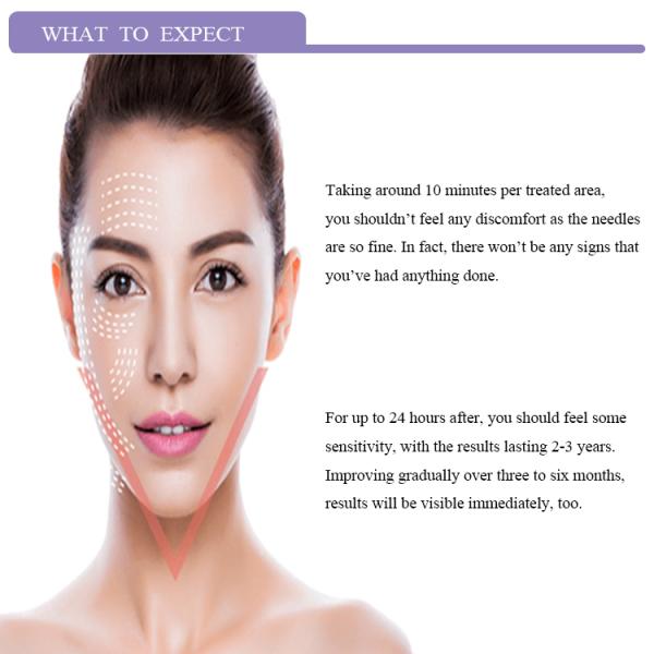 packaging company medical absorbable polydioxanone suture thread ultra v lift thread