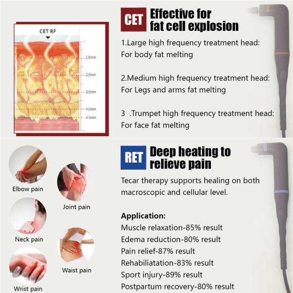 Body Slimming RF Radio Frequency Machine RET CAP Monopolar Face Wrinkle Remover