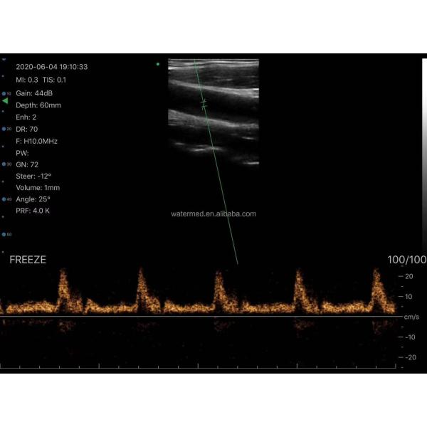 Wireless Android Ultrasound Highest Cost-effective Double Probes Wireless Color Doppler Ultrasound Scanner 3 in 1 Ultrasound