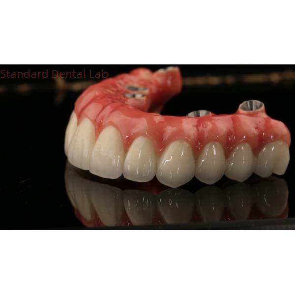 Full Arch Zirconia Implants Bridge Zirconia Crown Vita Shade Customized All On Four / Six Dental Implant