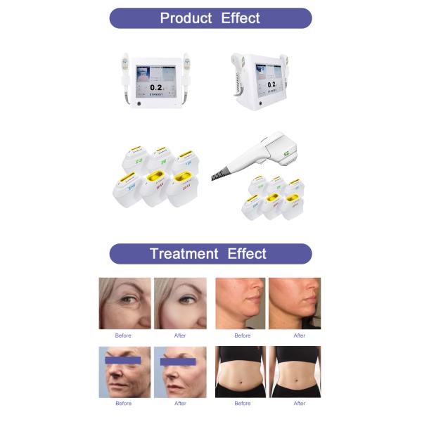 7 Hifu Cartridge 2 Handles 7d HIFU Portable Machine Face Lifting Body sculpt