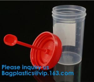 China Urine Container, Disposable Urine Collector Urine Specimen Container,Urine Specimen Cup,Sterile or Non Sterile wholesale