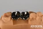Single Or Multiple Restorations Dental Abutments And Bars With Internal Hex