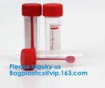Disposable Urine Specimen Cup/Urine Sample Containers/Urine Collection Cup
