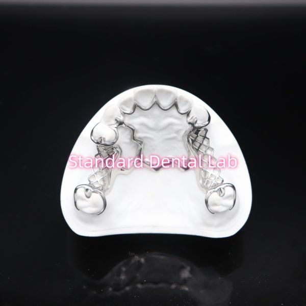 Printed Scheftner Metal Partial Denture Framework Accurate Customized Cast Partial Denture
