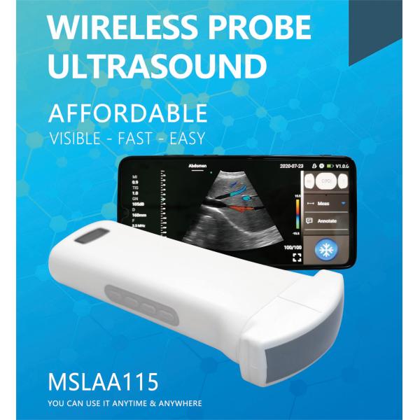 USB Convex Ultrasound Transducer Wireless Convex Array Ultrasound Probe for OB/GYN Lung Urology Application