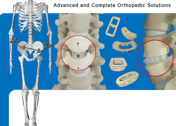 Spine Implants Cornerstone Peek Cage Customize Interbody Fusion Device