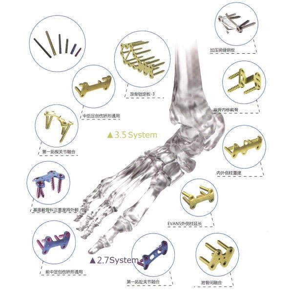 Orthopedic Implant Bone Fracture Titanium Locking Plate For Hands Foot