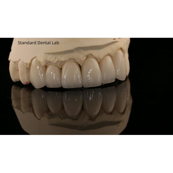 Full Arch Zirconia Implants Bridge Zirconia Crown Vita Shade Customized All On Four / Six Dental Implant