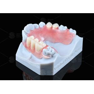 Natural Looking Valplast Partial Denture Longevity Highly Resistant To Fractures