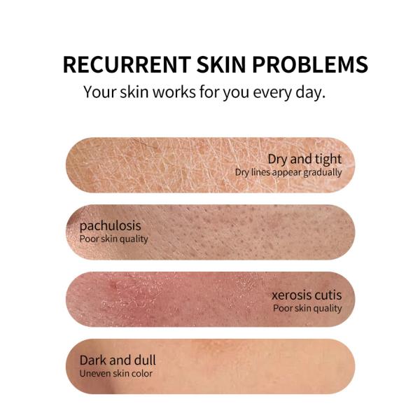 Best Vitamin C Turmeric Whitening Moisturizing Essence Water Shrinking Pores Removing Necrotic Cutin Facial Toner