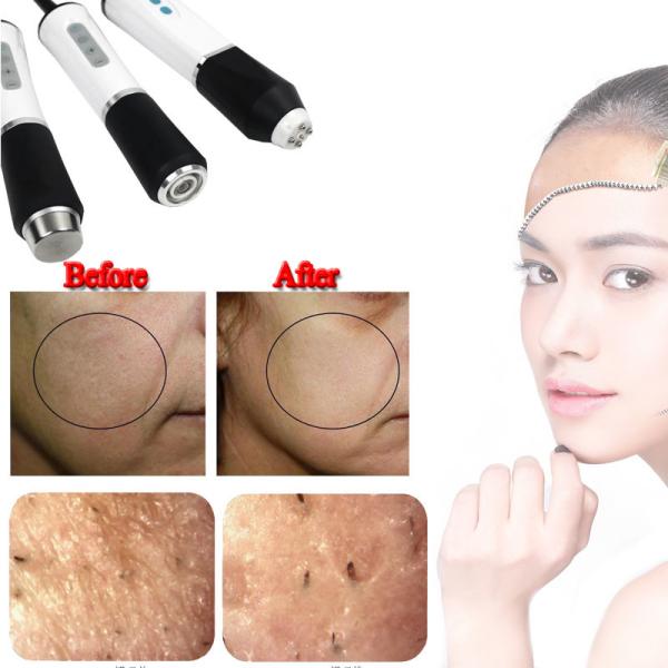 3 In 1 CO2 Bubble Machine Hydra Beauty Oxygenation RF Skin Tightening Facial Machine