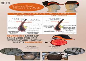 China Hair Loss System Helmet Cold Laser Hair Growth Cap for Hair Growth Faster wholesale