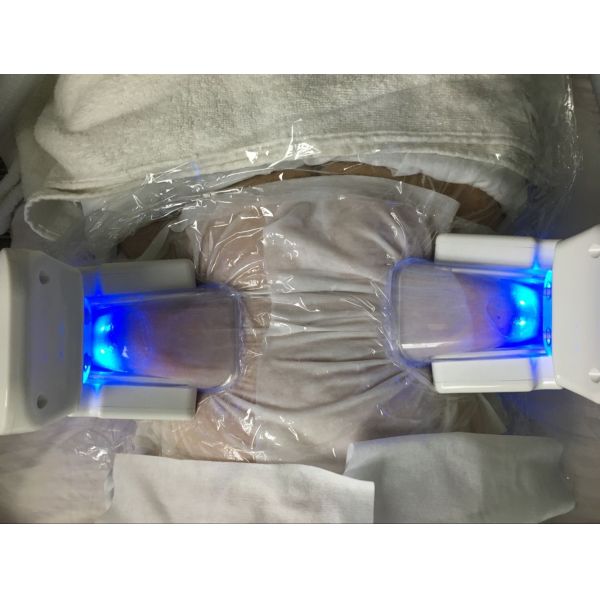 Wind + water+ semiconduct cooling Multi-functional cryo cool body sculpting machines